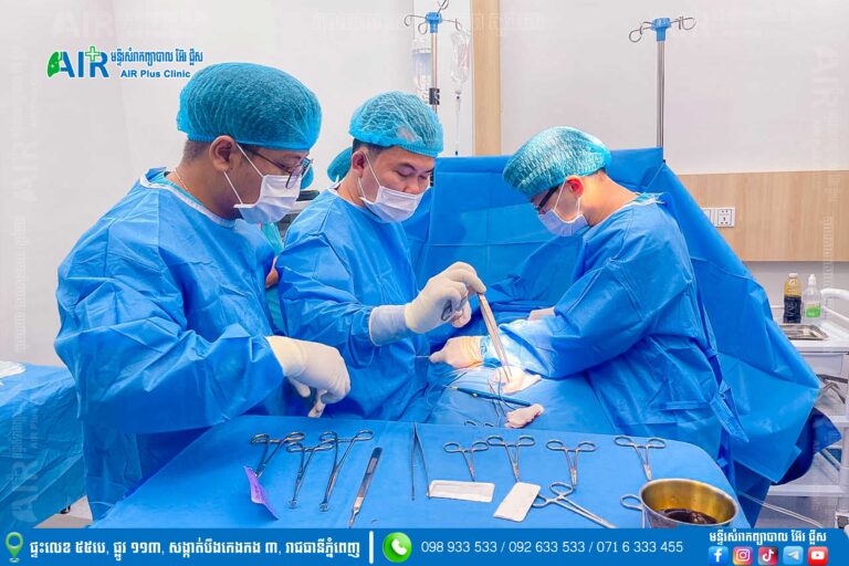 ការវះកាត់ជំងឺរលាកខ្នែងពោះវៀន